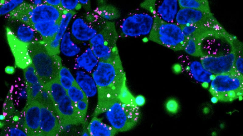 Microscopy image of human embryonic kidney cells in blue and green against a black background.