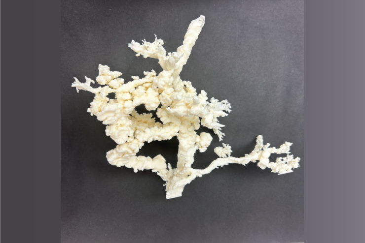 A 3D printed model of precancerous pancreatic lesions called PanINs found in histology images. The lesions were found to grow to extreme sizes within the pancreatic ducts. Credit: Ashley Kiemen