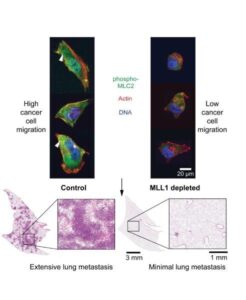 Microscopy image of cancer cell migration in relation to MLL1 depletion