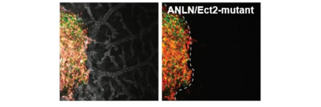 Four microscopy images showing primary tumor formation.