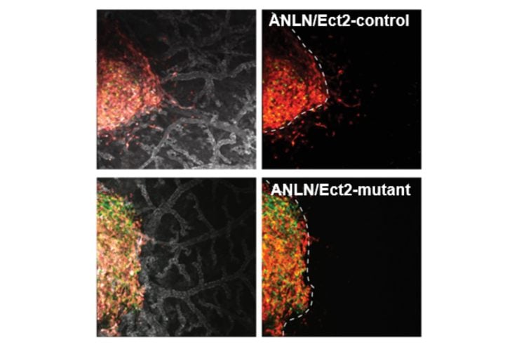Four microscopy images showing primary tumor formation.