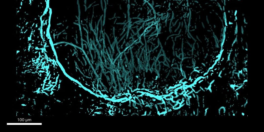 Microscopy image of nerves in a non-healing skull defect four weeks after injury. The background in white with a predominately blue circle in center and lots of blue marks around the image.