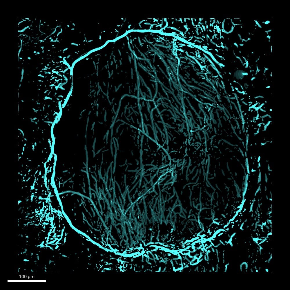Microscopy image of nerves in a non-healing skull defect four weeks after injury. The background in white with a predominately blue circle in center and lots of blue marks around the image.