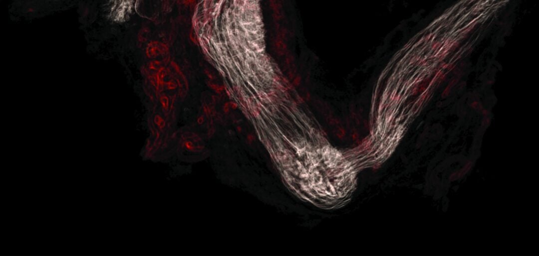 Microscopy image of a fallopian tube in red against a black background.
