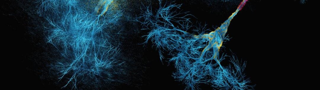 Graphic of two neurons in blue, yellow and pink.
