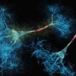 Graphic of two neurons in blue, yellow and pink.